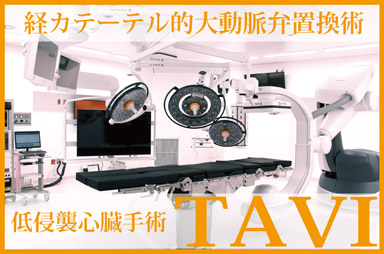 経カテーテル的大動脈弁置換術 TAVI