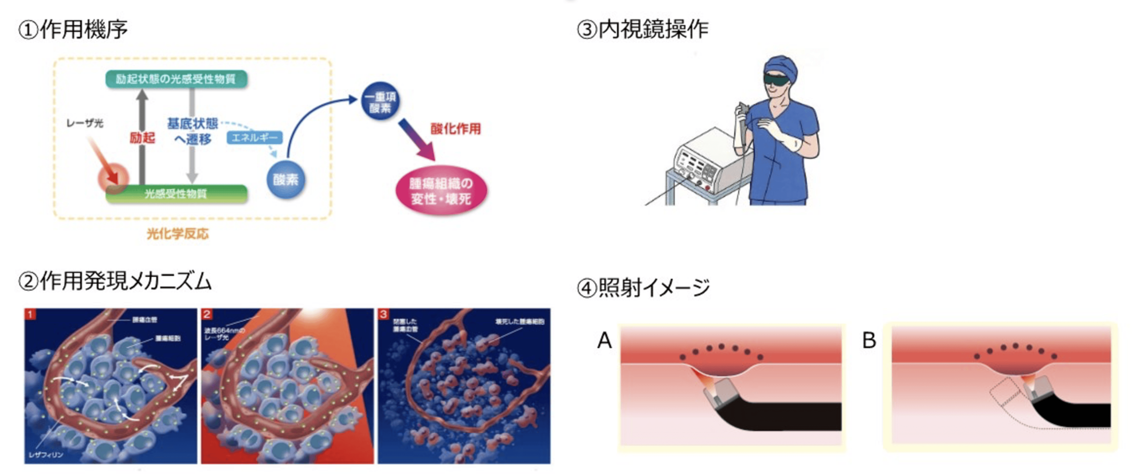 内視鏡手術｜東京医科大学病院低侵襲治療サイト