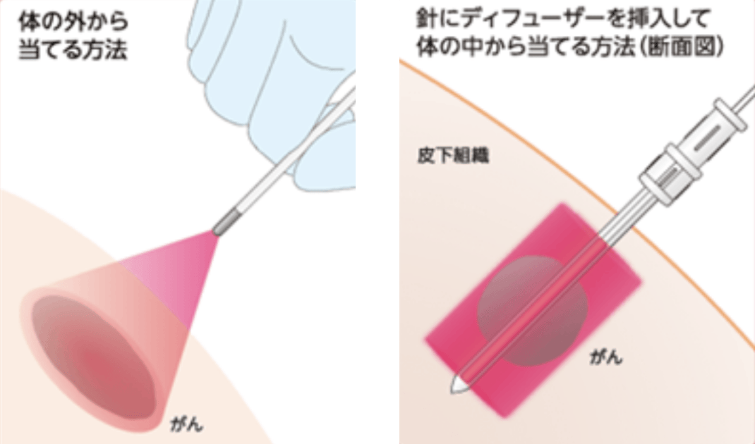 東京医科大学病院での特色